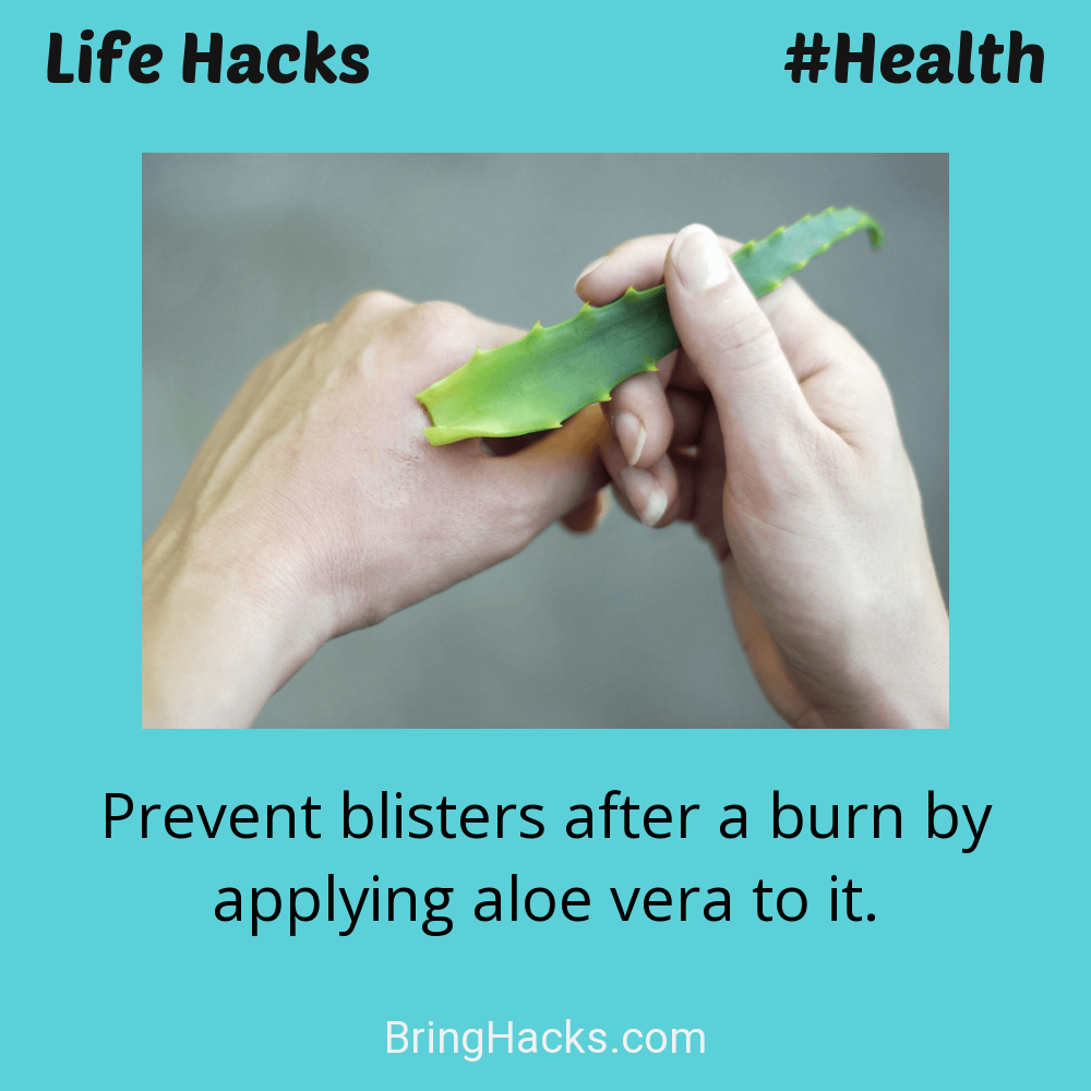 Life Hacks: - Prevent blisters after a burn by applying aloe vera to it.