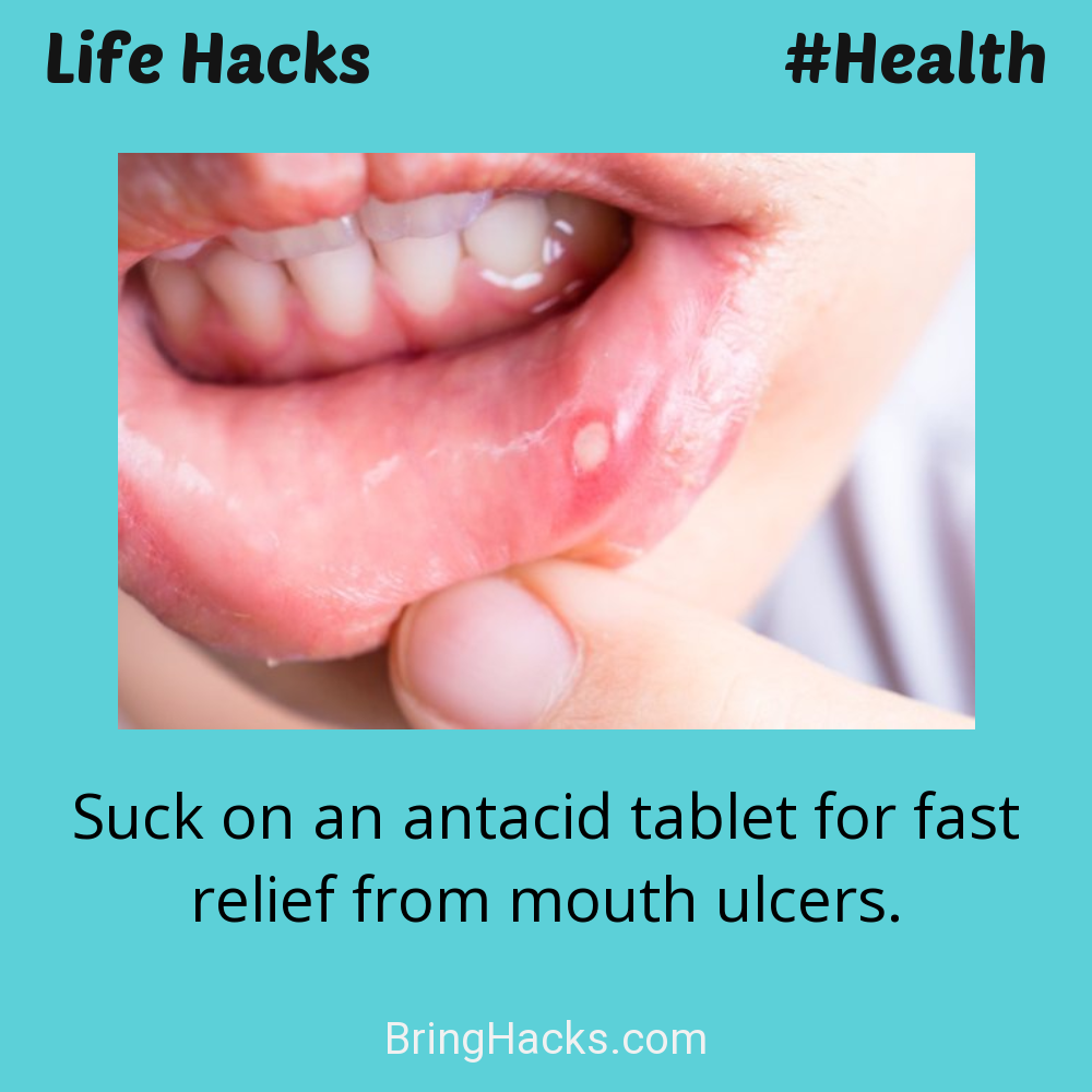 Life Hacks: - Suck on an antacid tablet for fast relief from mouth ulcers.